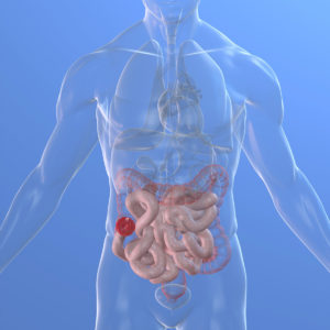 ostomy-management-certification Ostomy Management Certification
